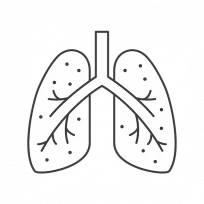 Simple illustration of asbestos particles lodged within a human pair of lungs